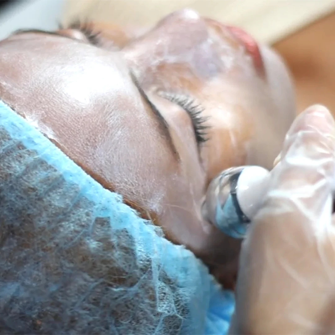 Iconique Hydrafacial Clarifying