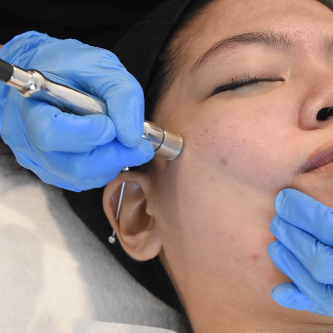 Iconique Hydrafacial Hydra Glow