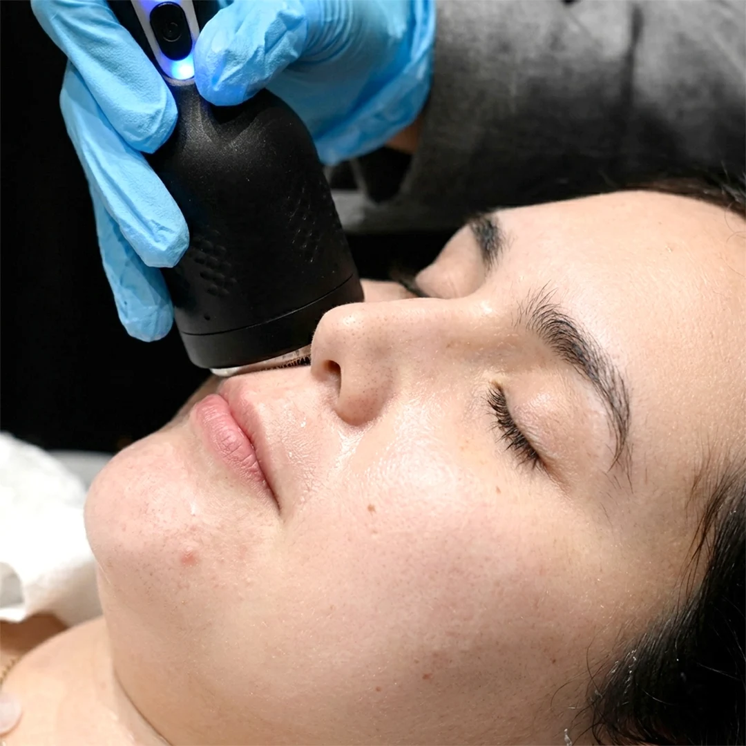 Iconique Microcurrent Facial Lifting