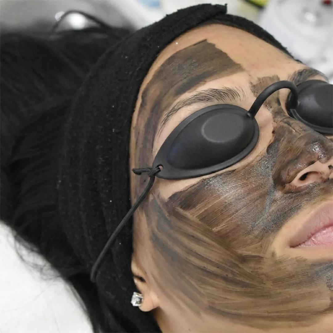 Iconique Pico Carbon