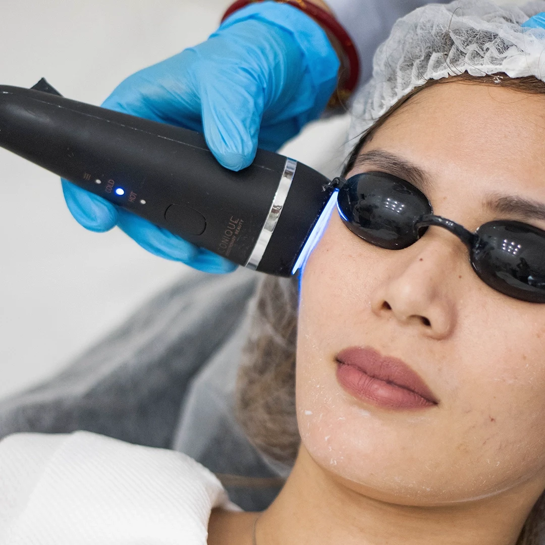 Iconique Pigmentation and Age Related Damages