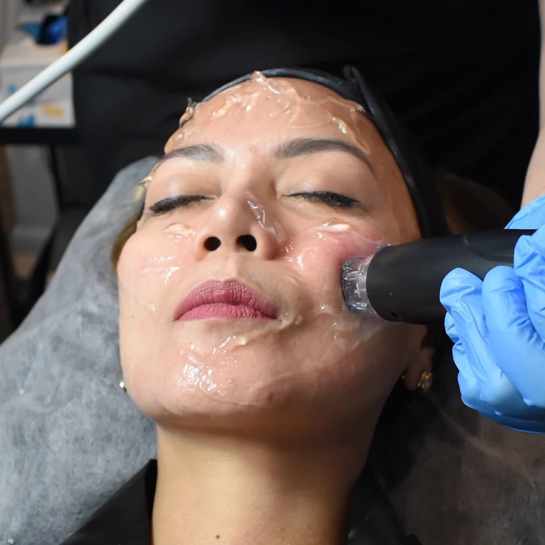 Iconique Thermagical