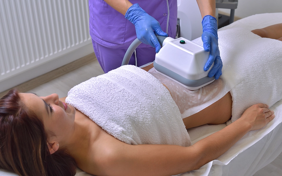 Cryolipolysis – 1 Area