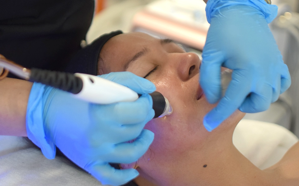 DIAMANT MIKRODERMABRASION