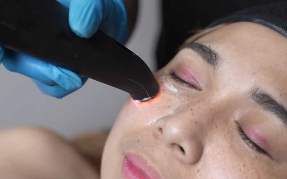 EYELIFT360 BIOPHOTON LICHTTHERAPIE