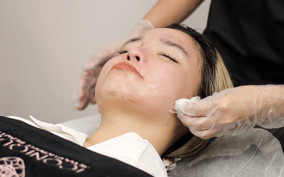 HYDRAFACIAL AKNE-ABWEHR