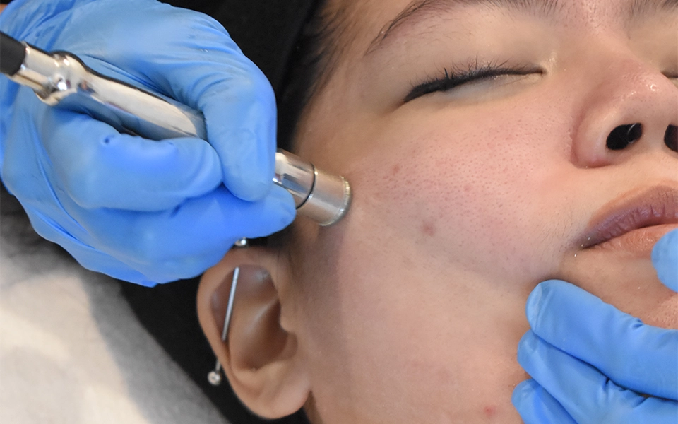 HYDRAFACIAL HYDRA-GLOW