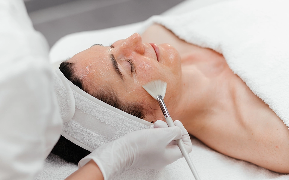 Lactic Acid Peeling 80%