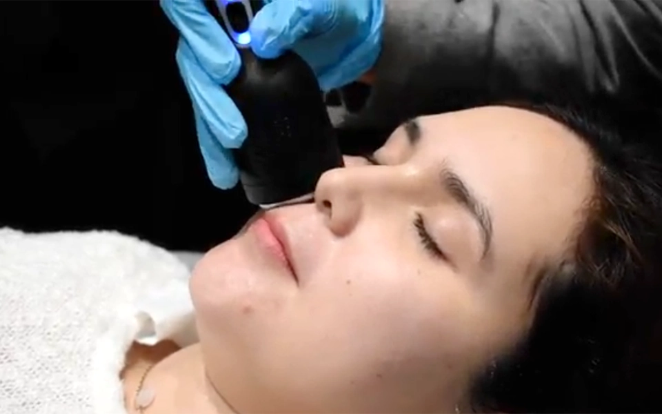 MIKROSTROM GESICHTS-LIFTING