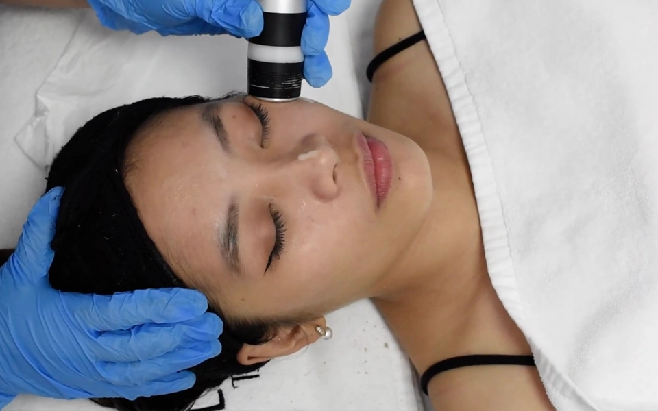 RF HAUTSTRAFFUNGS-BEHANDLUNG