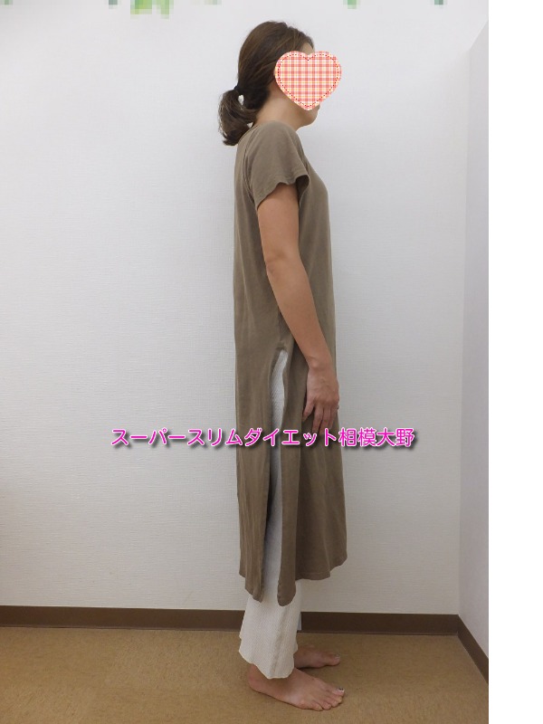 -12.3kg達成!!(期間:3ヶ月 W様 30代主婦 )