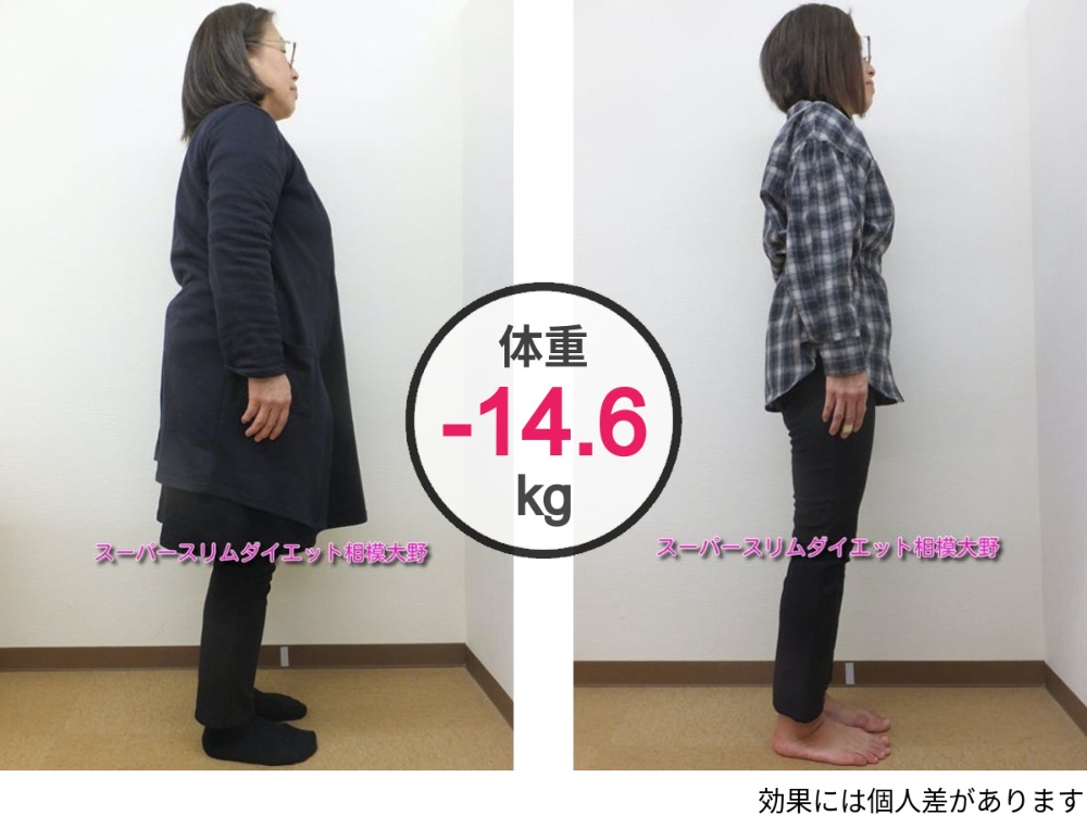 耳ツボダイエット 無料カウンセリング