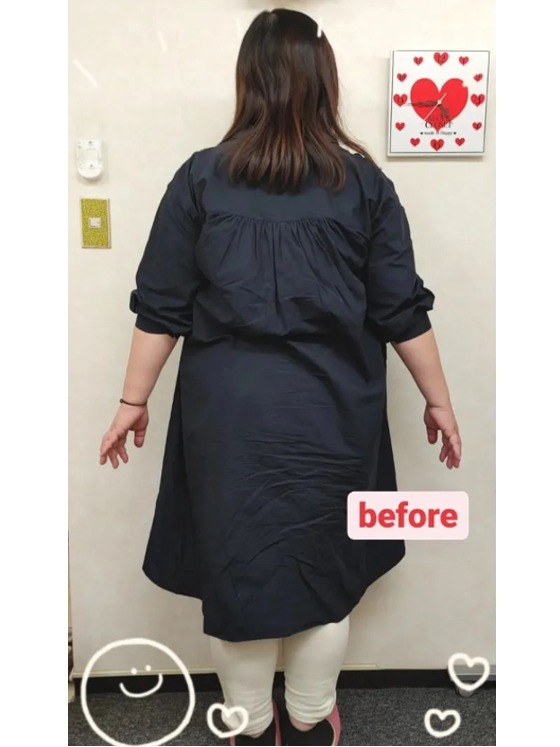 洋服もスッキリ着れるようになりました。(40代)