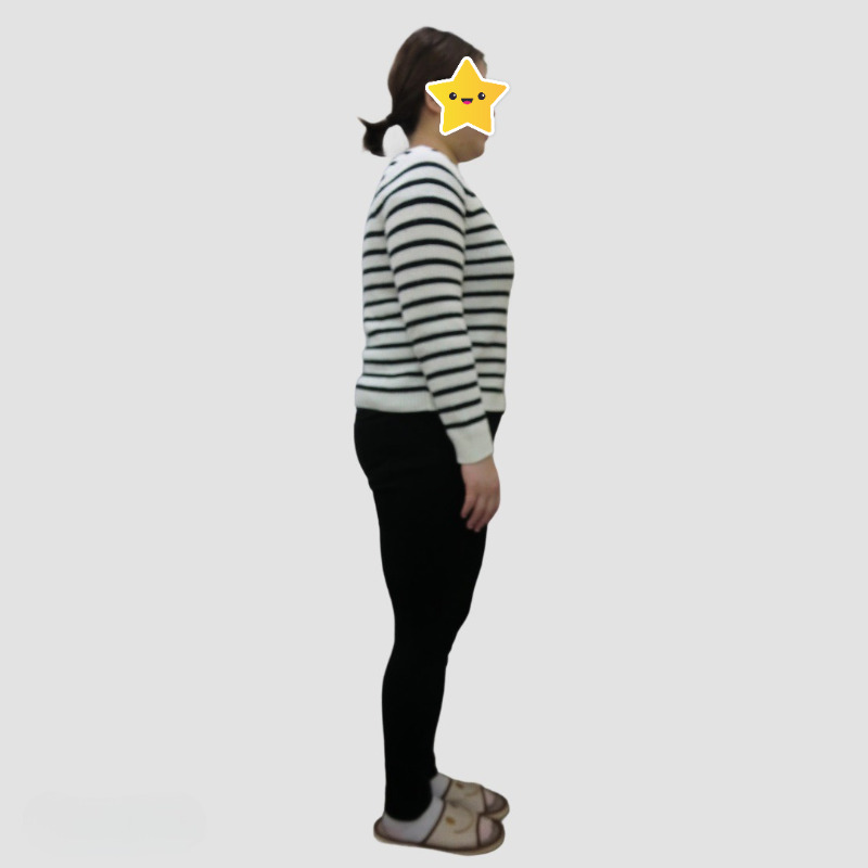 18ヶ月:-19.5kg達成!(20代 女性)