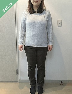 -20.6kgのダイエット(N様 30歳)