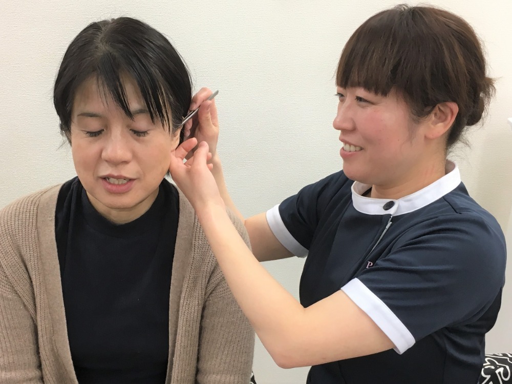 耳ツボダイエット 施術1回