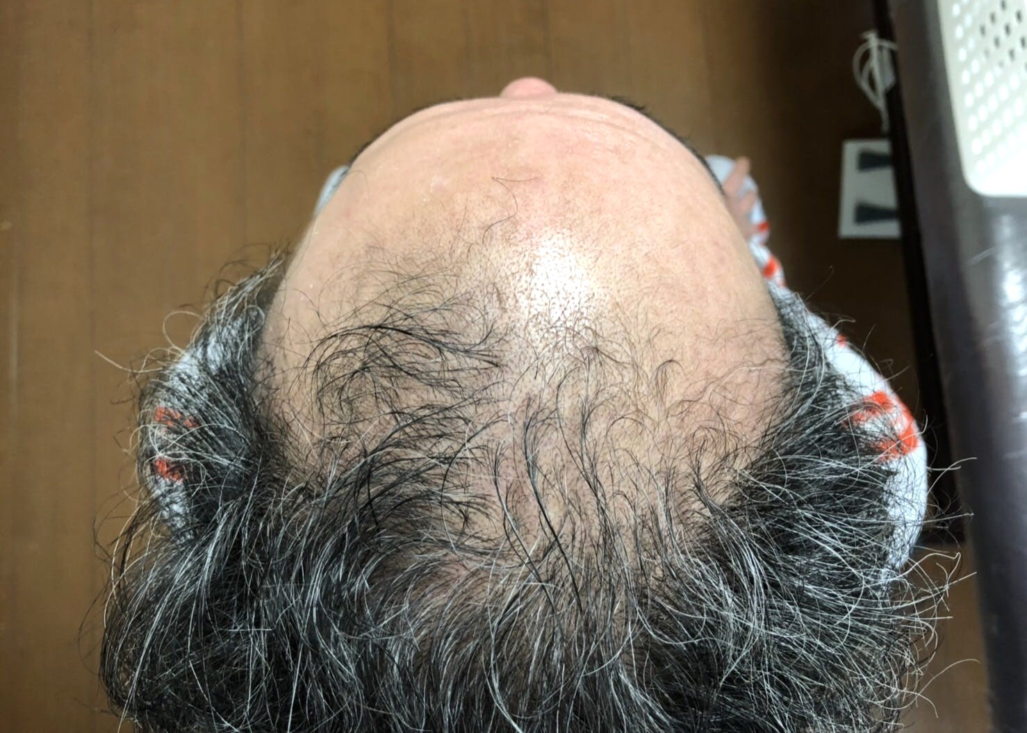 効果実証済みの根本的な頭皮改善