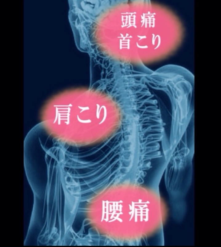 腰痛・ぎっくり腰・坐骨神経痛・首肩こり・ヘルニア・狭窄症など