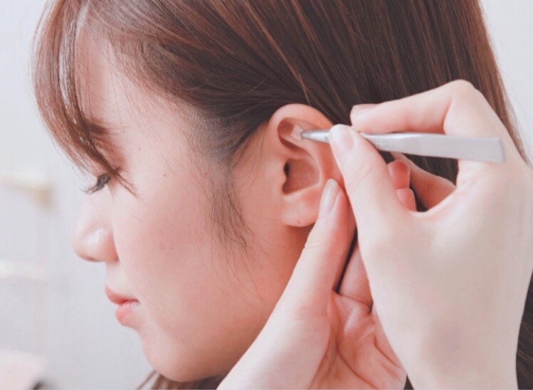 耳つぼダイエット カウンセリング+施術体験