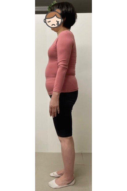 59歳/ずっと下半身がぽっちゃりでコンプレックスでした。