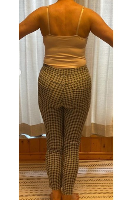 耳ツボダイエット:3か月でしっかりと体質改善(60代)