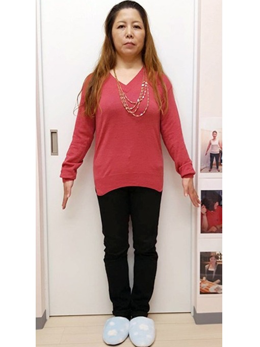 耳ツボダイエット:-12.5kg (Aさん)