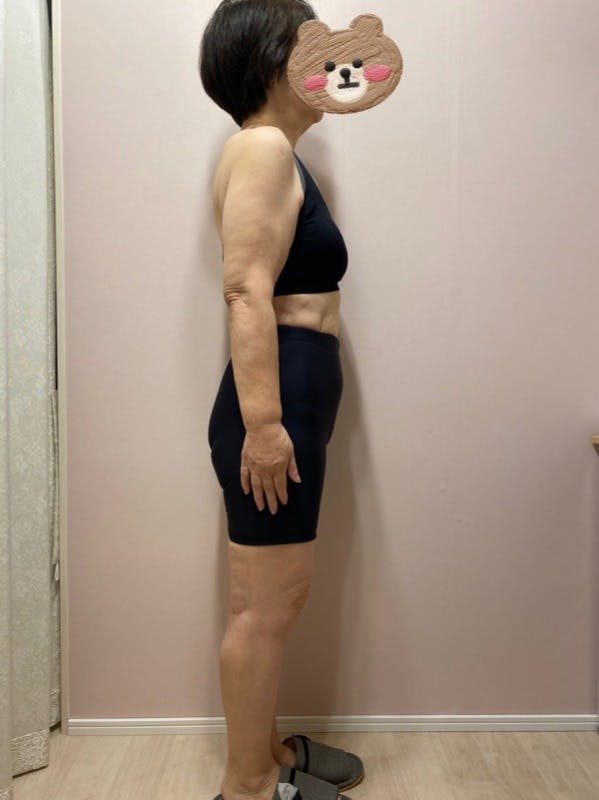68歳/お医者様から大絶賛していただきました。