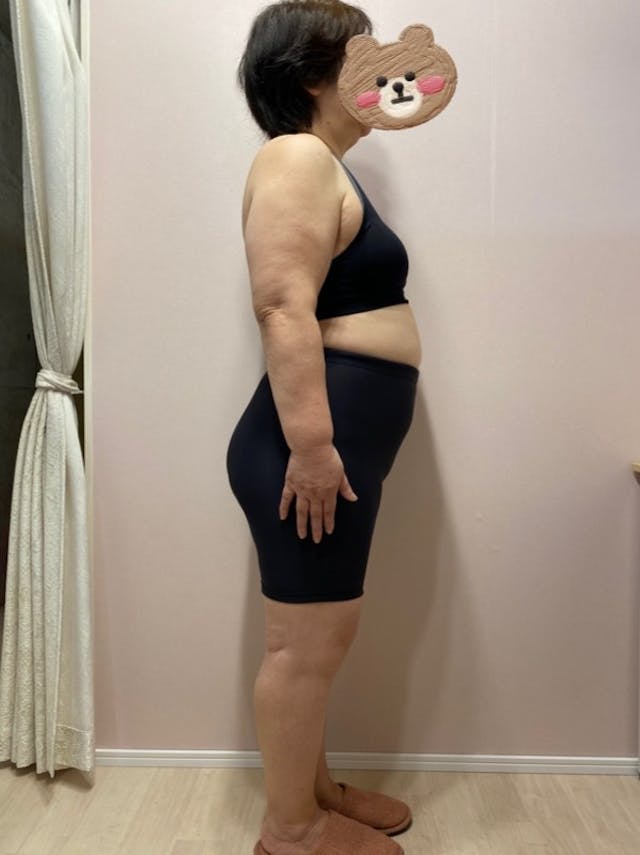 68歳/お医者様から大絶賛していただきました。