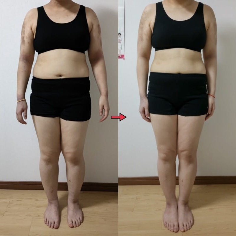 耳ツボダイエット:運動なしで-6.5kg