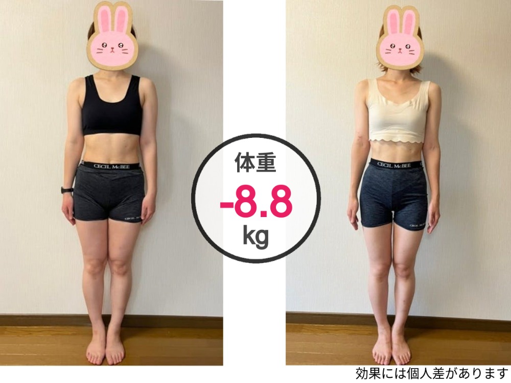 まずは【無料カウンセリング】あなたのキレイはここから始まる!