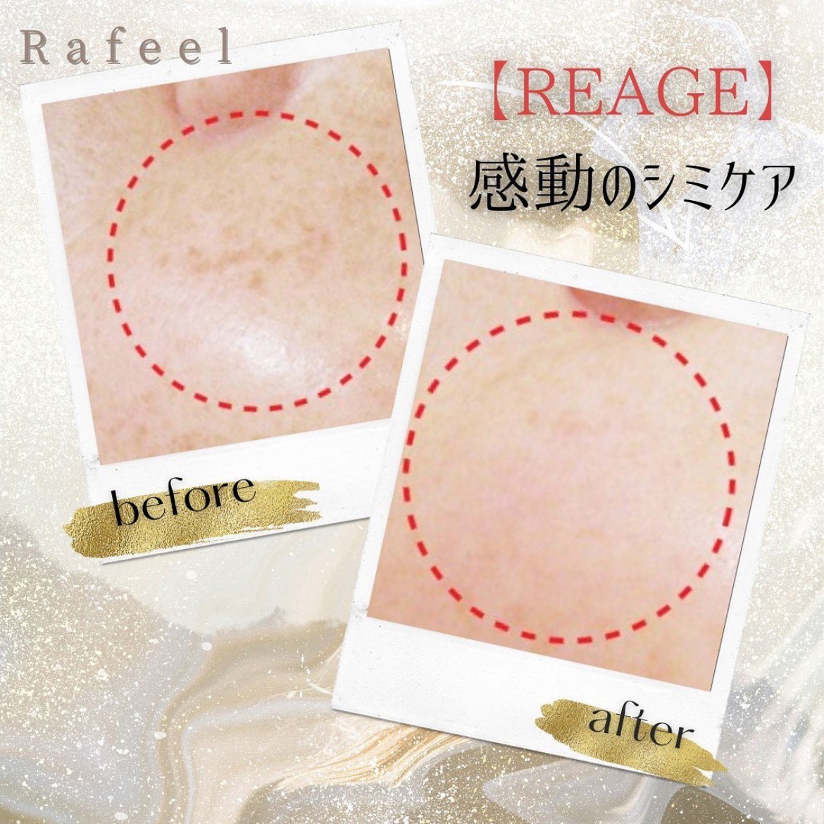 NEW 【REAGE】感動のシミケア