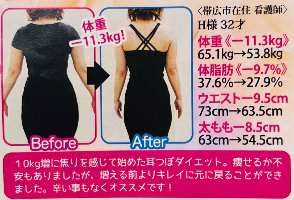 3ヶ月で綺麗に元に戻ることができました。