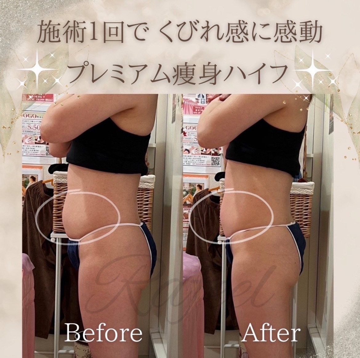 たった１回で！くびれ感に感動。