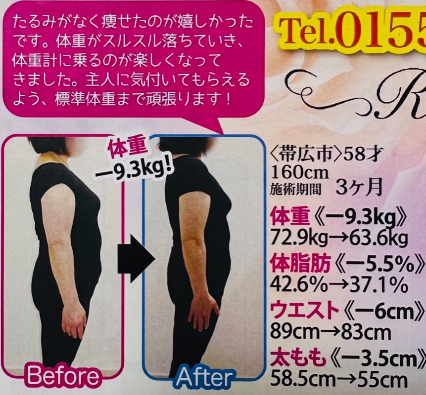 3ヶ月たるみがなく痩せたのが嬉しかったです