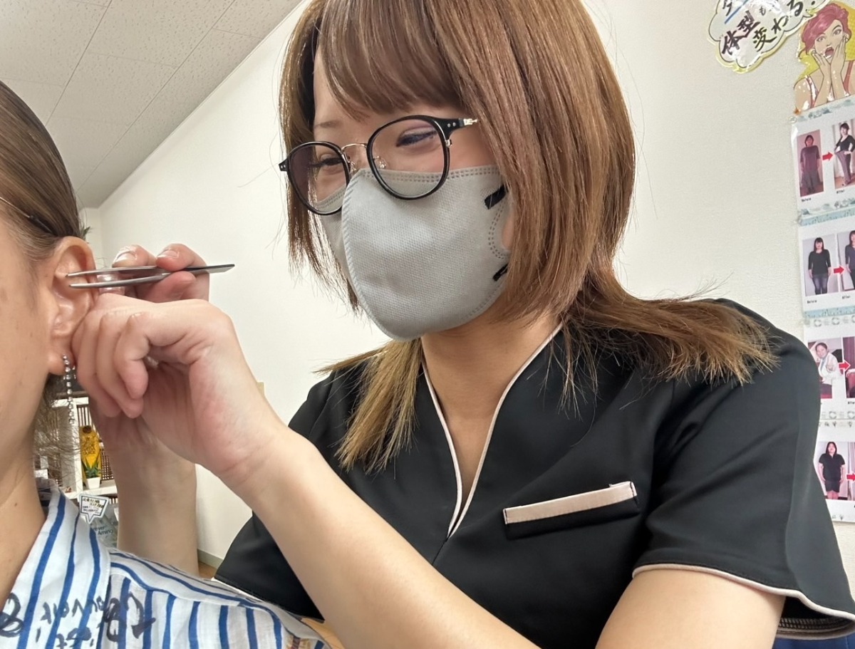 耳ツボダイエット 施術1回