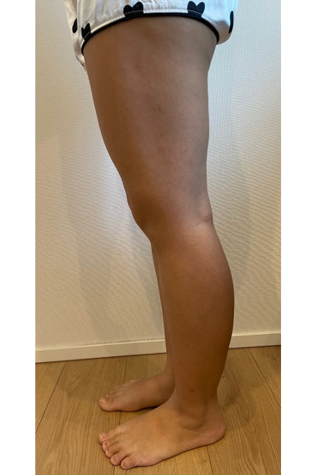 耳ツボダイエットで脚痩せもできた!