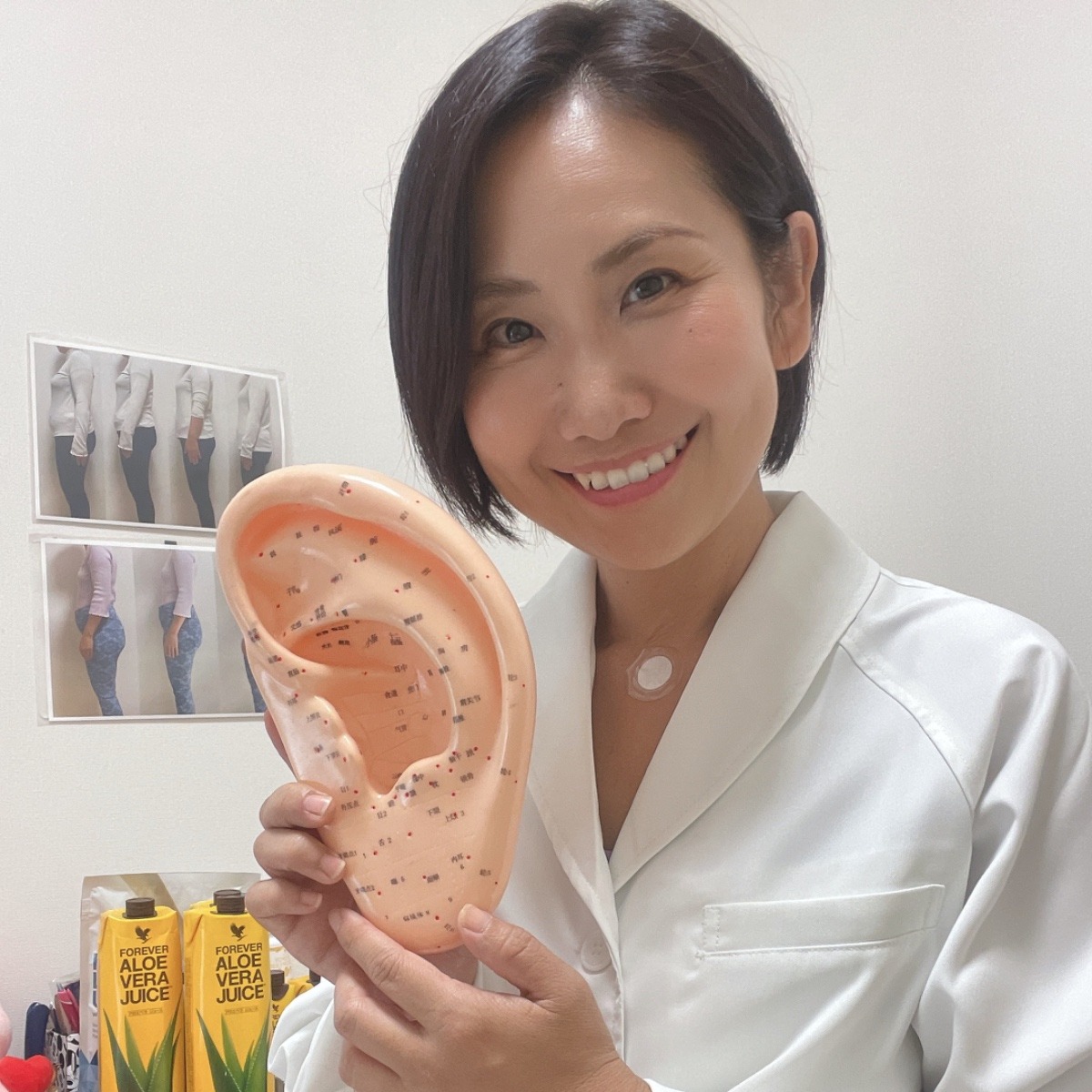 耳ツボダイエット 施術1回