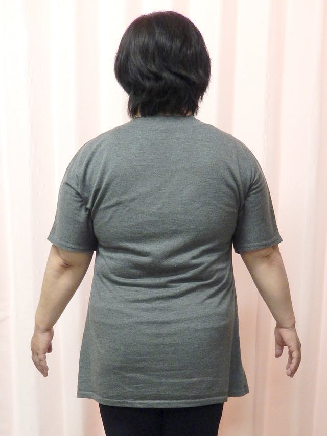 3ヵ月で-14kgのダイエット（T様 59歳 女性）