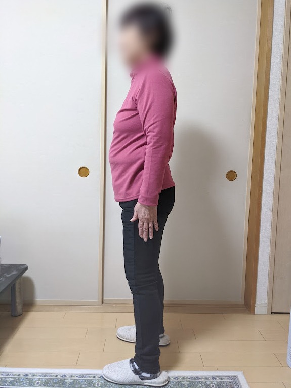 耳ツボダイエットで-7kg達成！（M様 80歳）