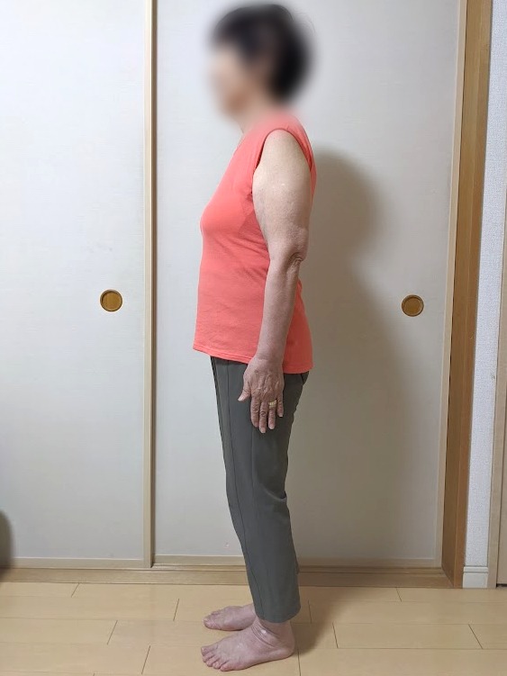 耳ツボダイエットで-7kg達成！（M様 80歳）