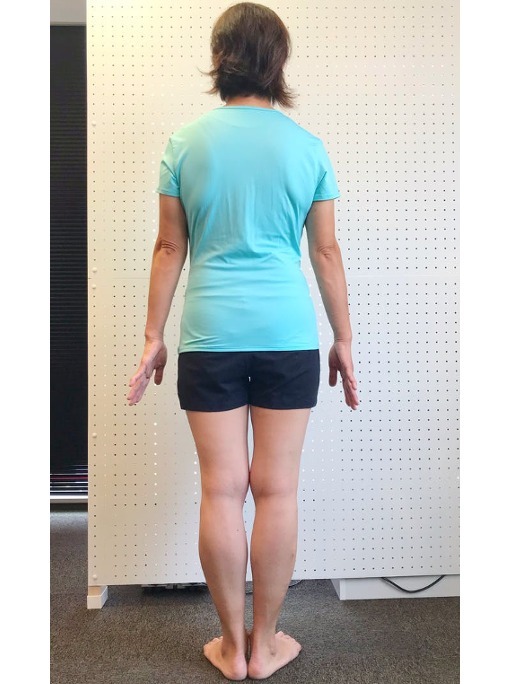検査結果に医師も驚愕!耳つぼダイエットで-18.6kg!