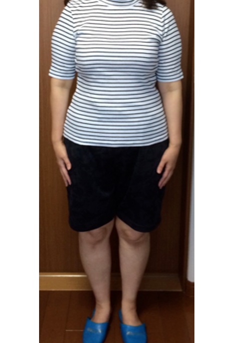 きつかった洋服が入るようになりました(Y様 50歳)