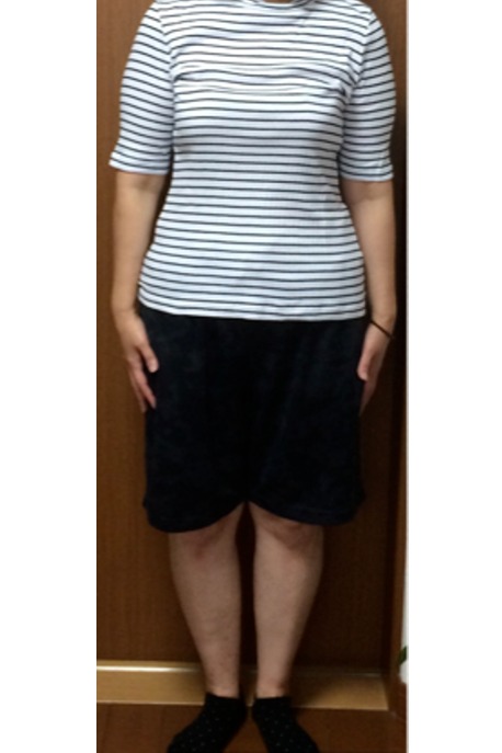 きつかった洋服が入るようになりました(Y様 50歳)