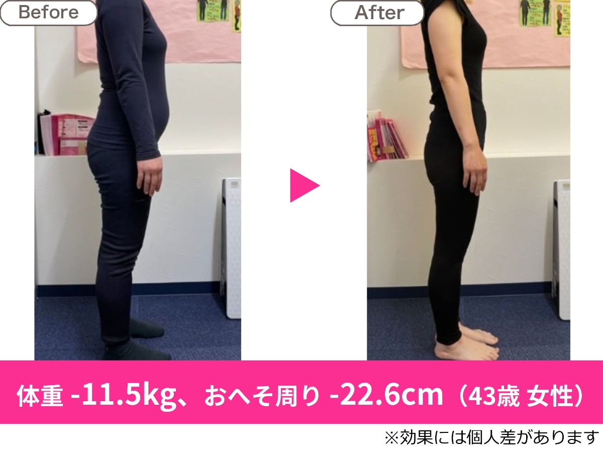耳ツボダイエット 無料カウンセリング