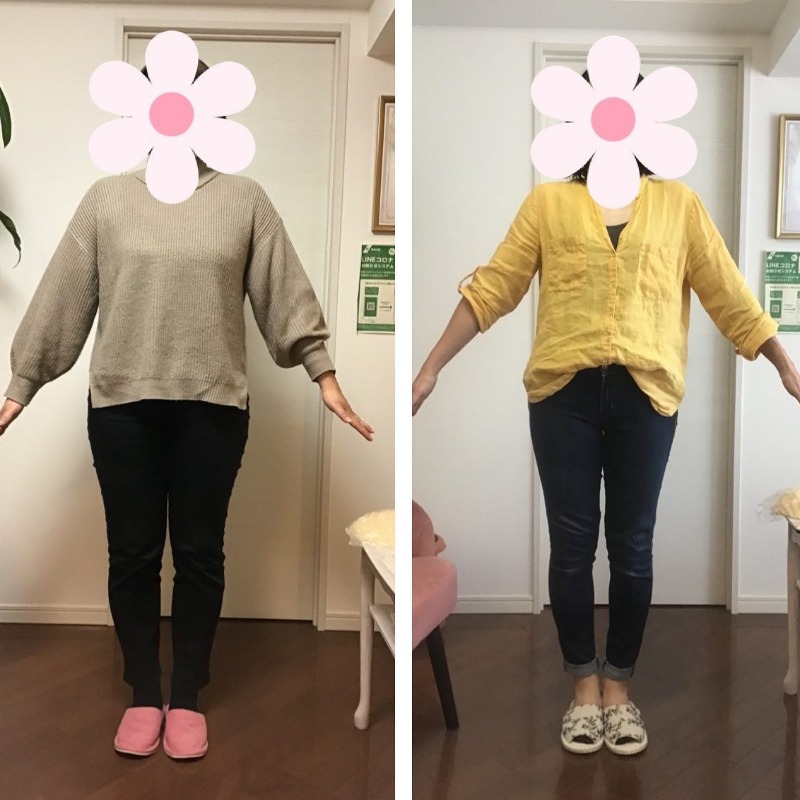 体重−17.7kg! (I様 40代)