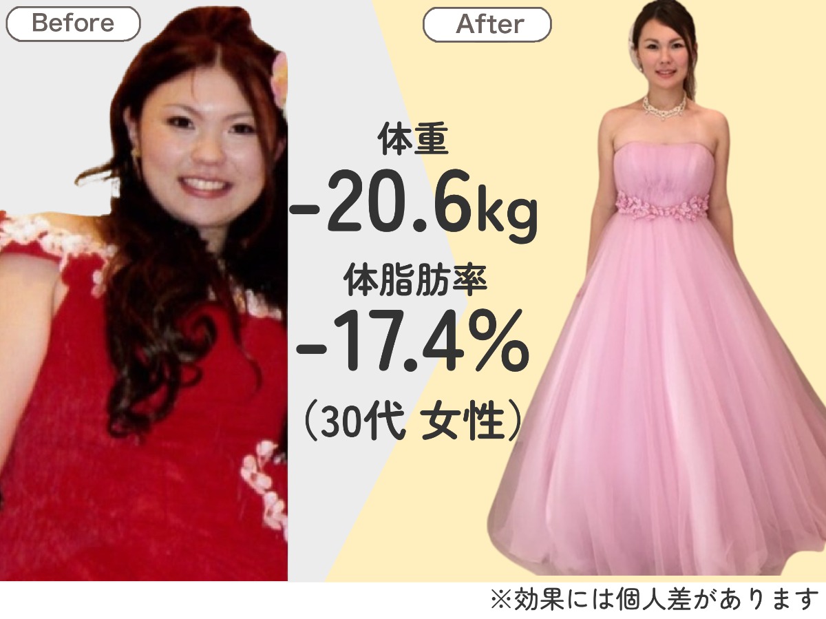 耳ツボダイエット 無料カウンセリング