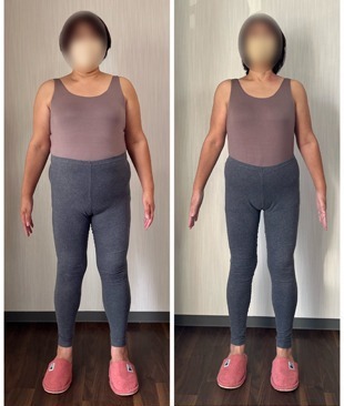 4ヶ月で-15.7kgのダイエット(156㎝ 54歳)