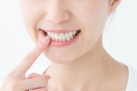歯のセルフホワイトニング
