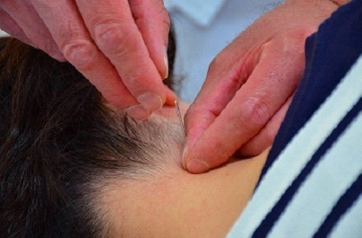 頭痛（根治鍼・電気治療）