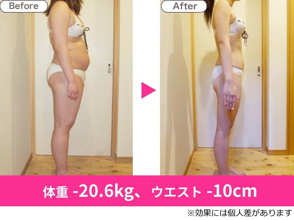耳ツボダイエット 無料カウンセリング